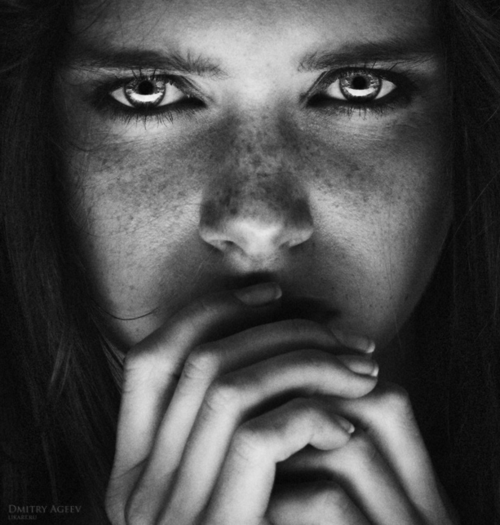 black and white, photography,freckles